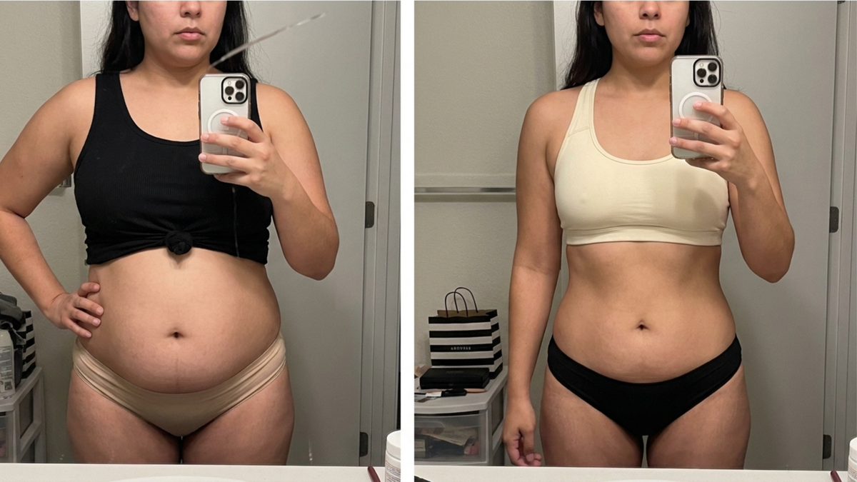 Before and after — Jennifer L.
