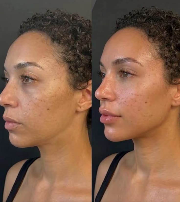 Before and after — Jennifer L.