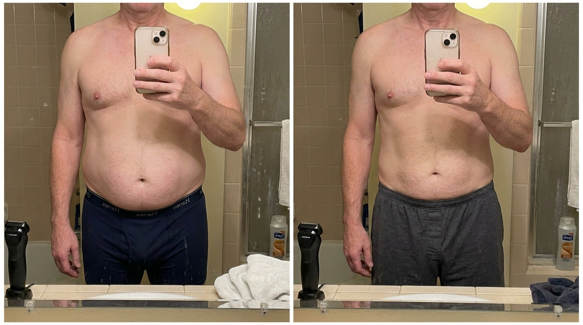 Before and after — David R.