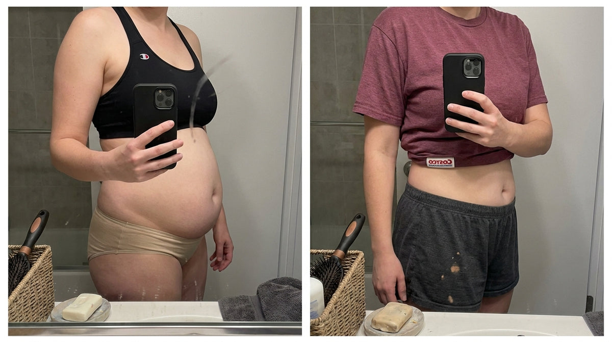 Before and after — Sarah M.
